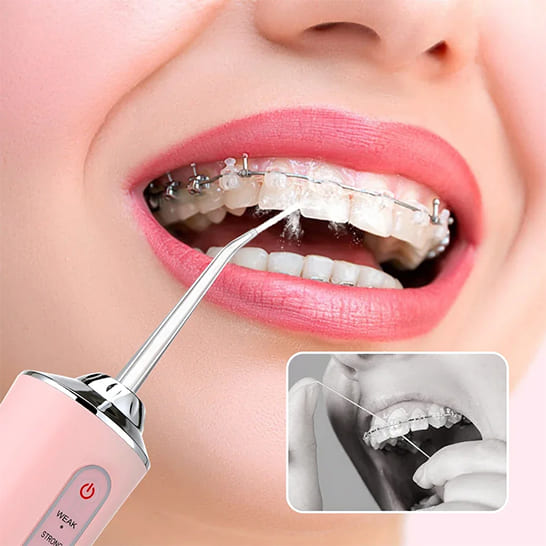 Irrigador Bucal Portátil: Limpieza profunda donde el cepillo no llega 🦷✨